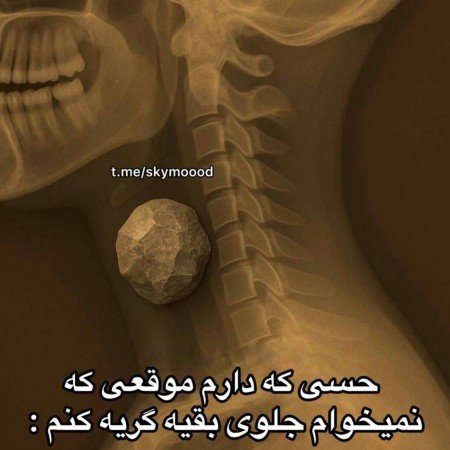  عکس پروفایل تیکه دار غمگین