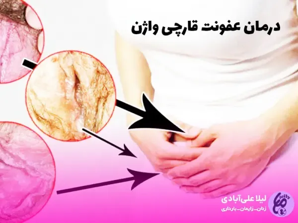  عکس انواع عفونت واژن