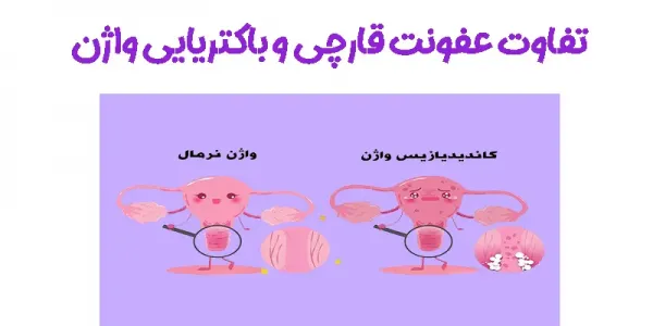  عکس عفونت واژن