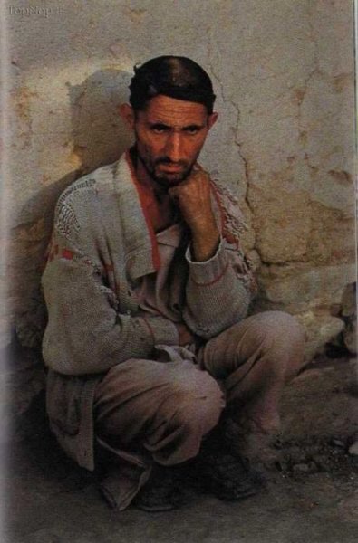 عکس افغانی زشت