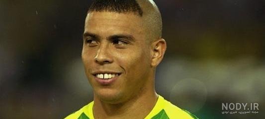  مدل موی رونالدو در النصر