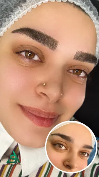  عکس میکرو ابرو قبل و بعد
