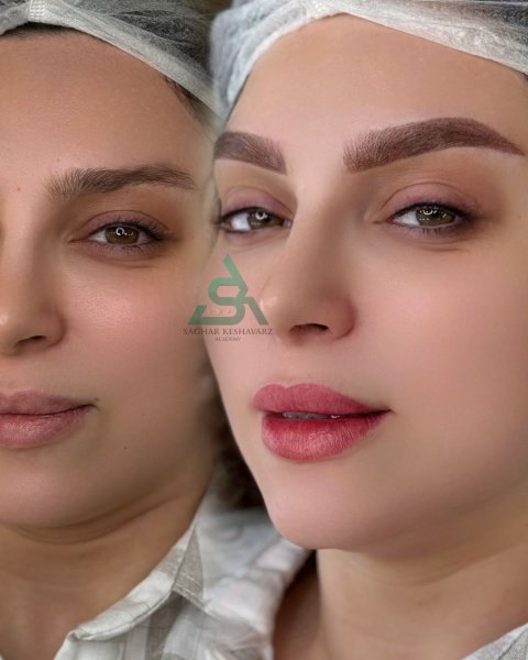  عکس میکرو ابرو قبل و بعد