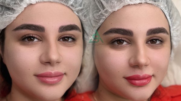  عکس میکرو ابرو قبل و بعد دخترانه