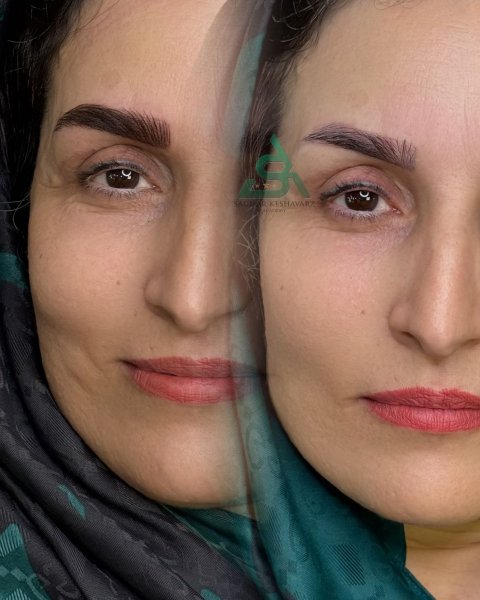عکس میکرو ابرو بعد از یک ماه