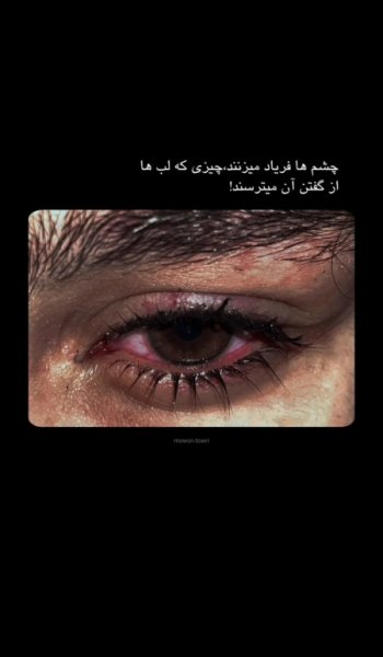  عکس چشم عاشقانه برای پروفایل