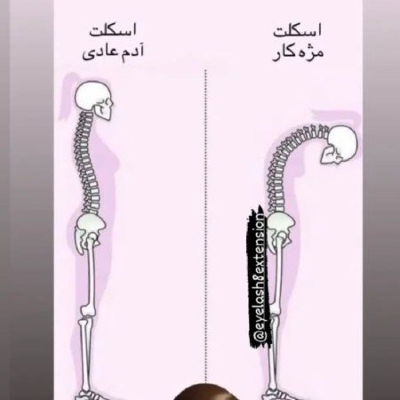  عکس اسکلت غمگین