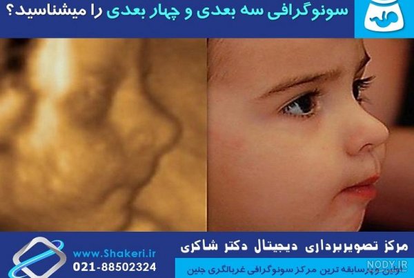  عکس سونوگرافی پسر