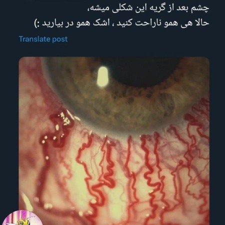  عکس اشک
