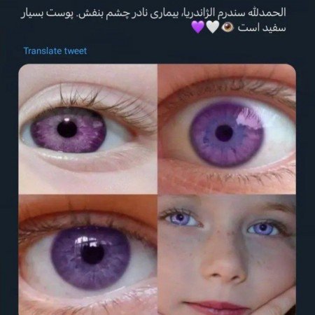  عکس چشم سبز