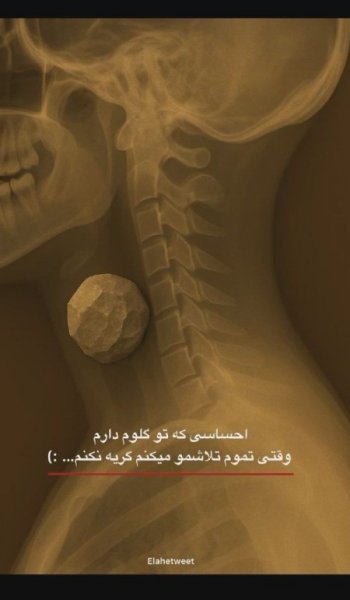  عکس پروفایل دل شکسته تنهایی