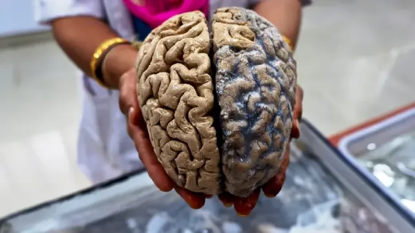  عکس مغز