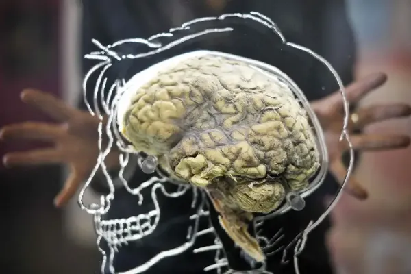  عکس مغز