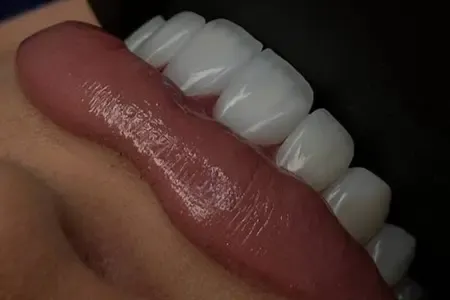 عکس آتلیه کودک پسر یک ساله