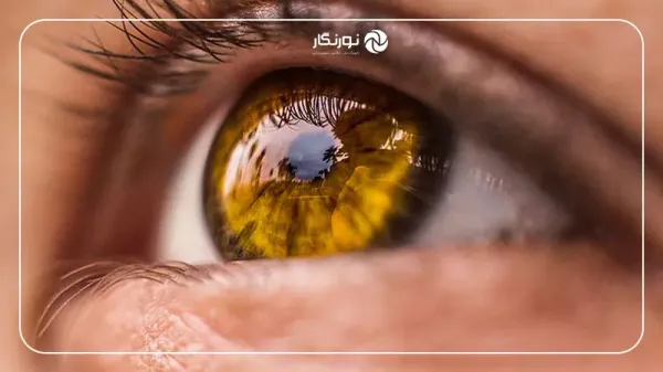  عکس چشم از نزدیک