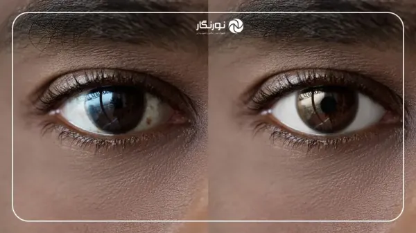  عکس چشم از نزدیک