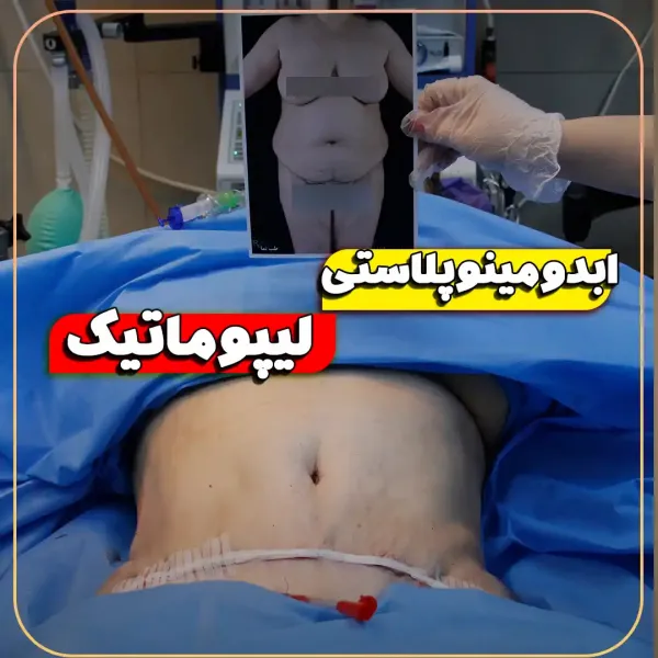  عکس جراحی شکم زن